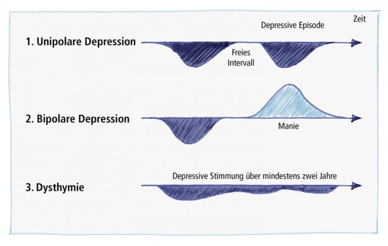 Wie lange dauert eine Depression? - wohlersein.de